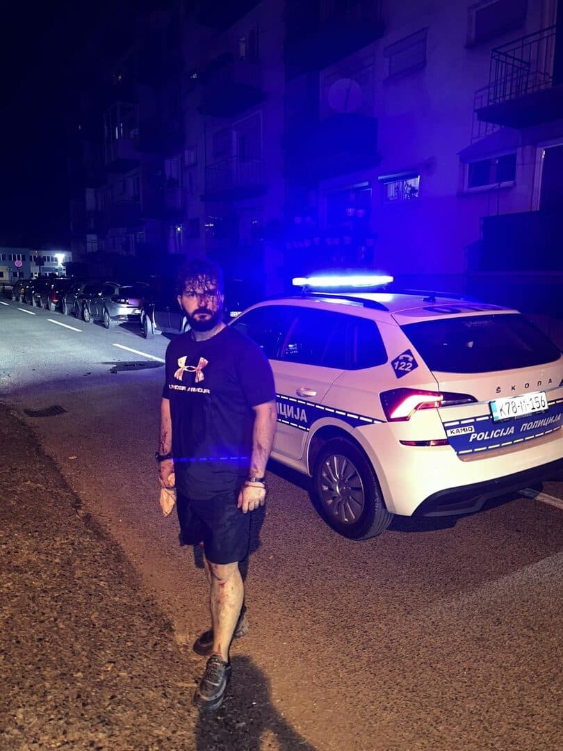 Dervišević: Da nije bilo reakcija, sve bi bilo zataškano - slika 1