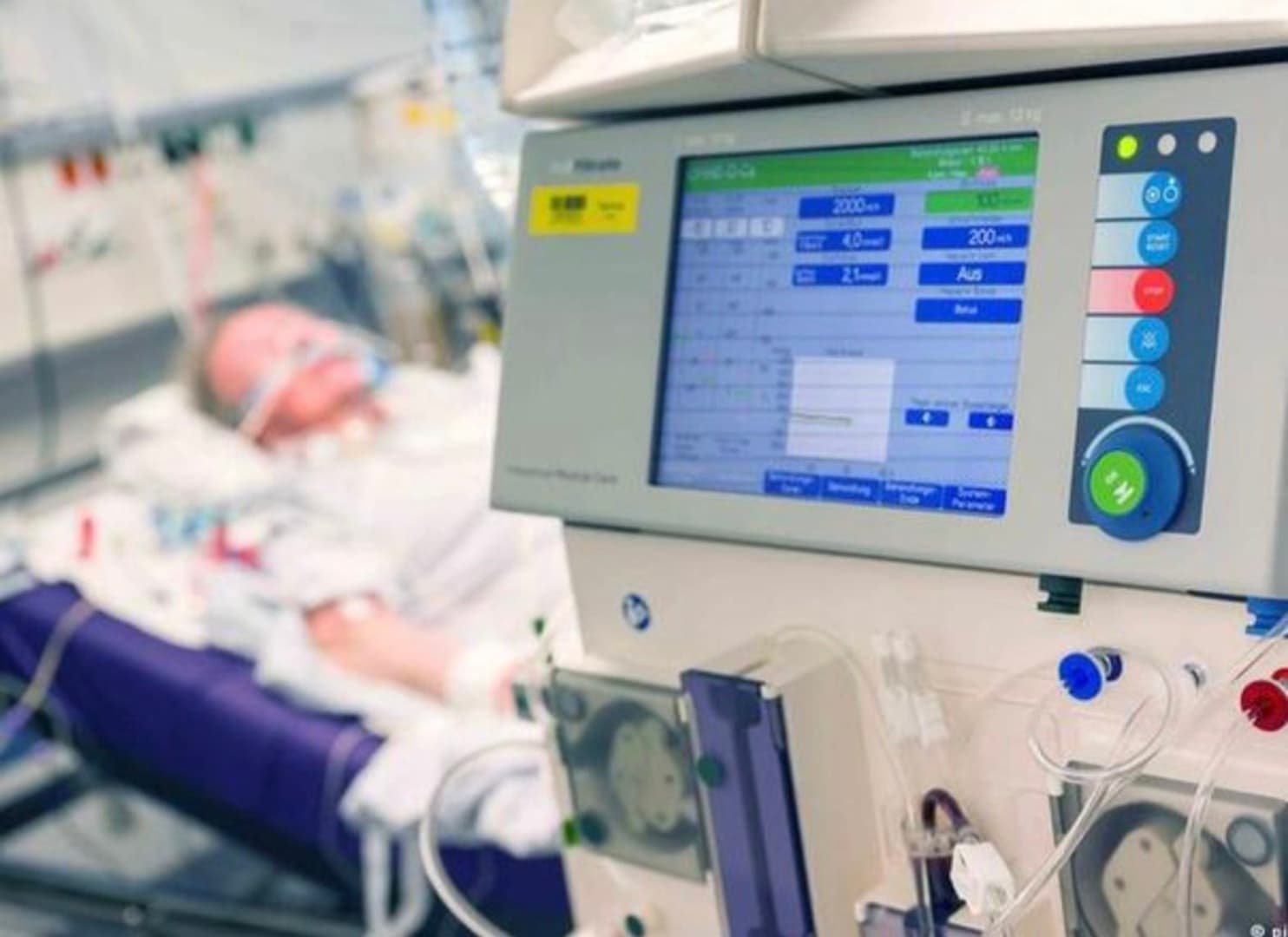 Afera "respiratori" u Mađarskoj: Prevara teška 826 miliona eura - slika 1