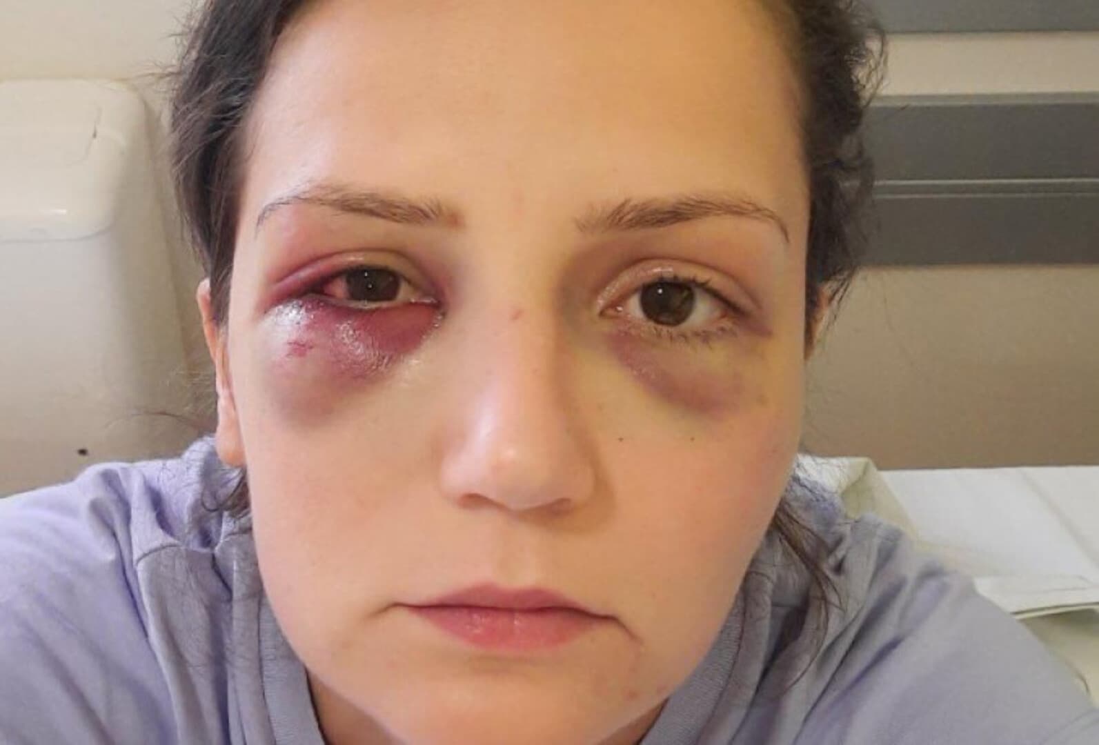 Počinje suđenje vlasniku hotela za napad na radnicu - slika 1