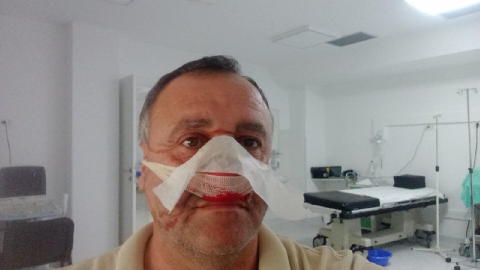 Pretučen kandidat za načelnika opštine Rudo - slika 1