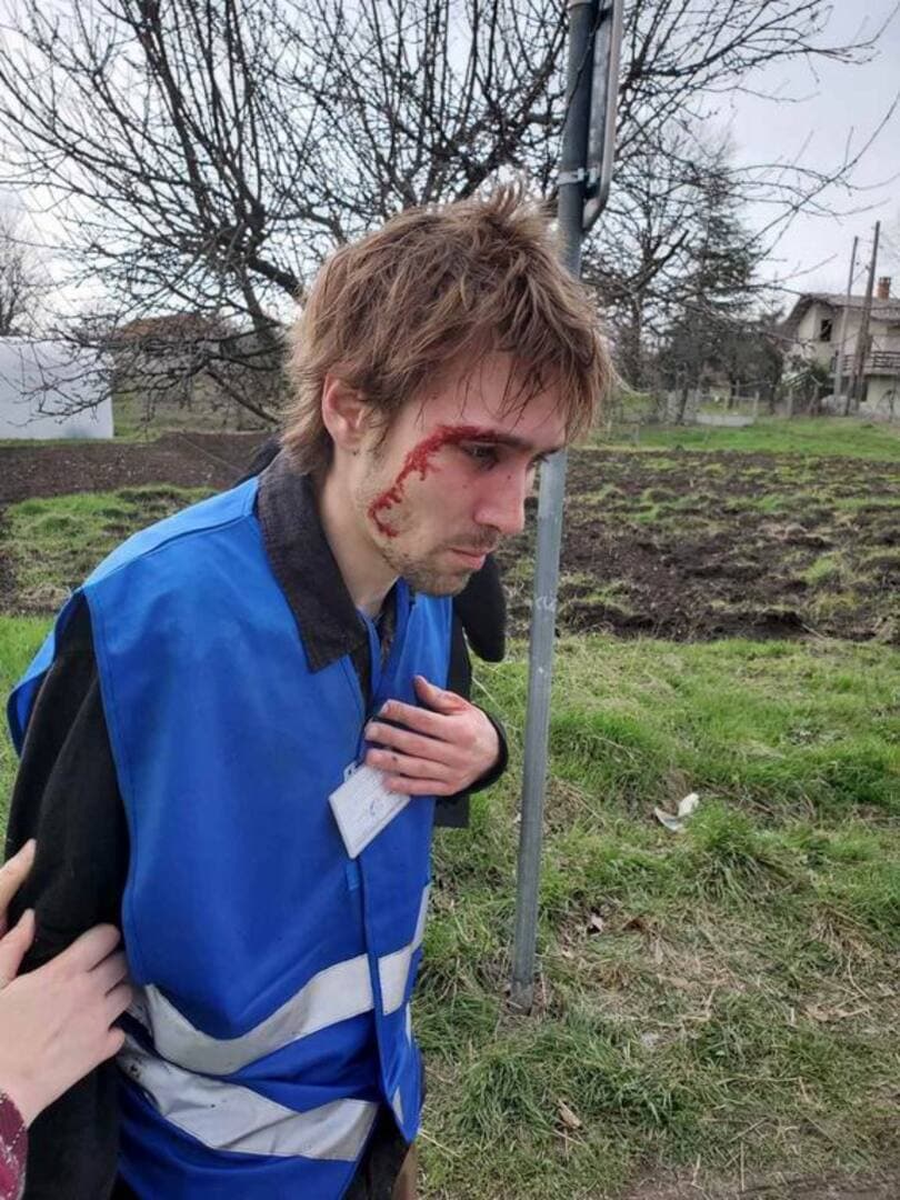 Haos u Srbiji: Vučićevi batinaši prebili studente. Dodik mu čestitao na pobjedi - slika 1